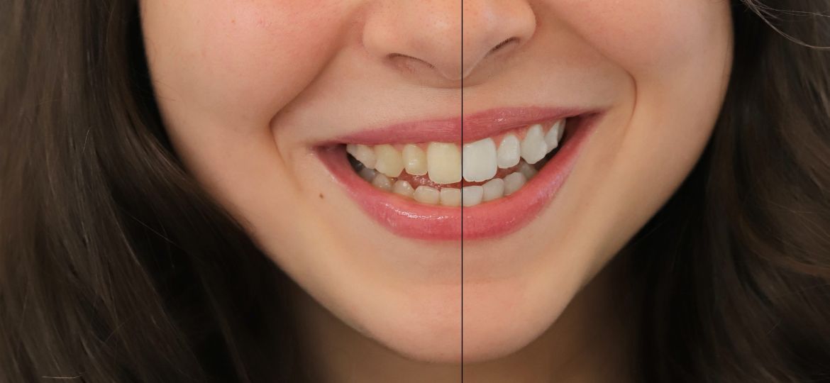 Finished-results-scaled